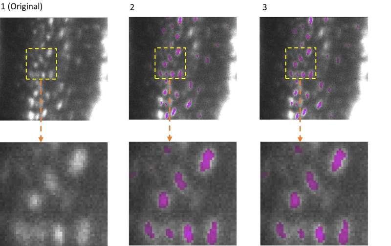 Analysis of microscopic images: EfficientBioAI – new open-source software makes AI models lighter and greener