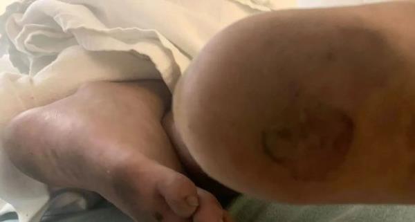 Rudy Farias feet after being found